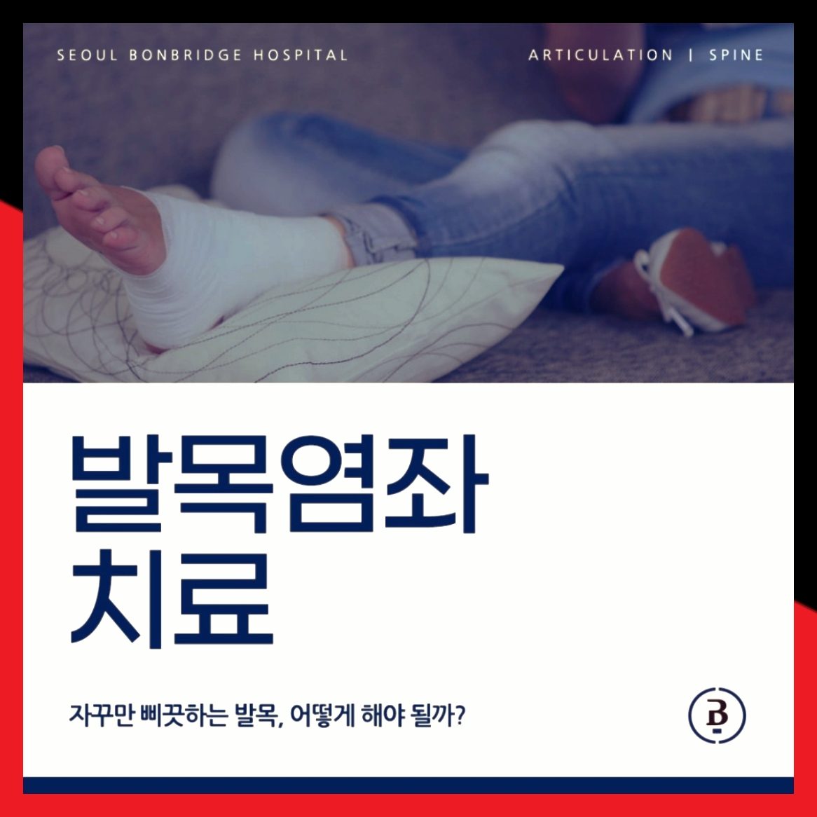 발목염좌 치료