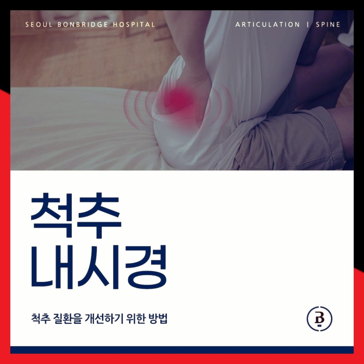 양방향 척추내시경
