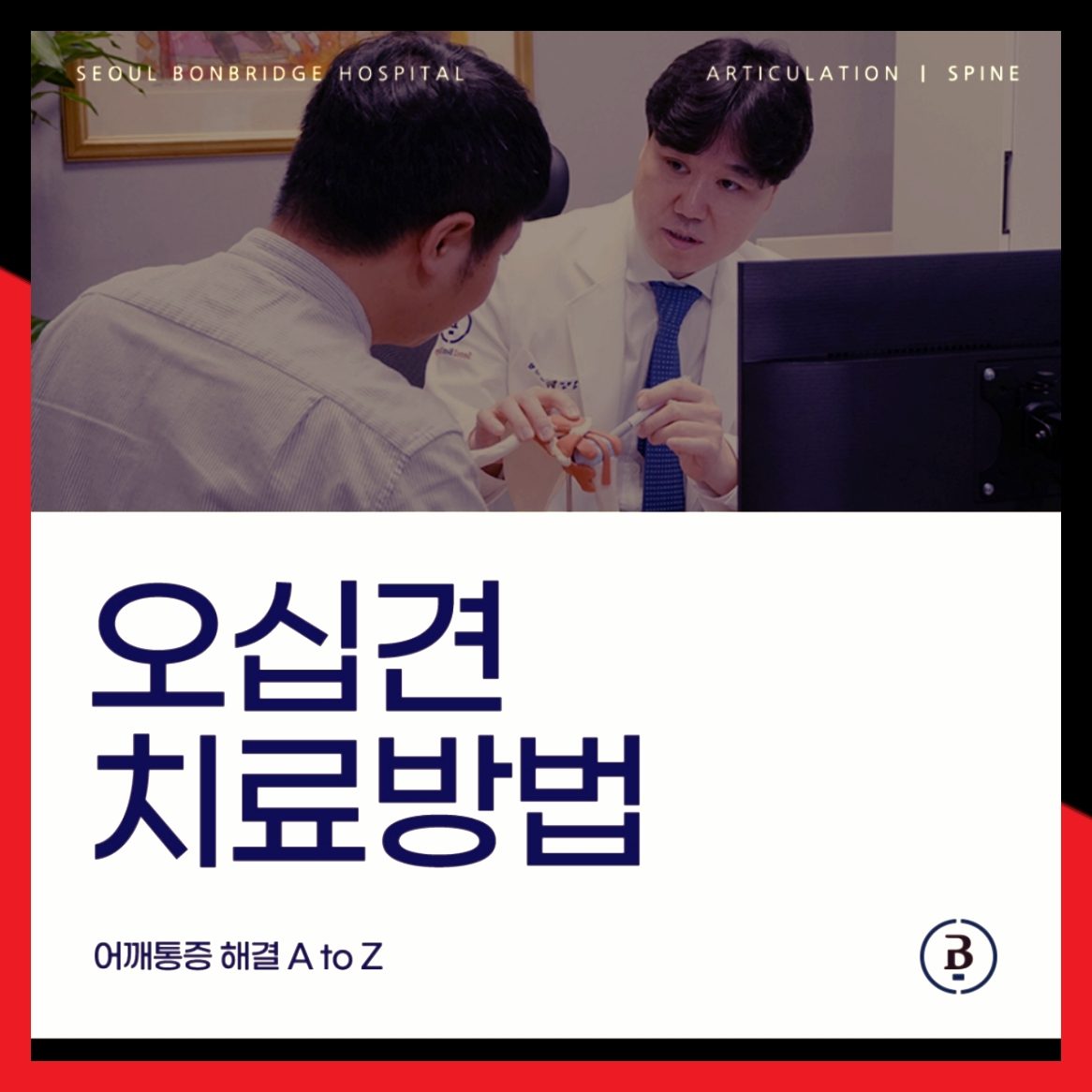 오십견치료방법