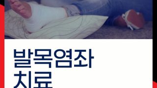 발목염좌 치료