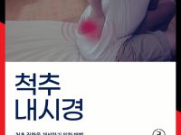양방향 척추내시경